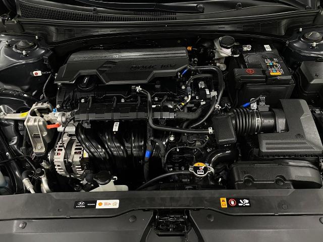 2024 Hyundai ELANTRA Vehicle Photo in Appleton, WI 54913