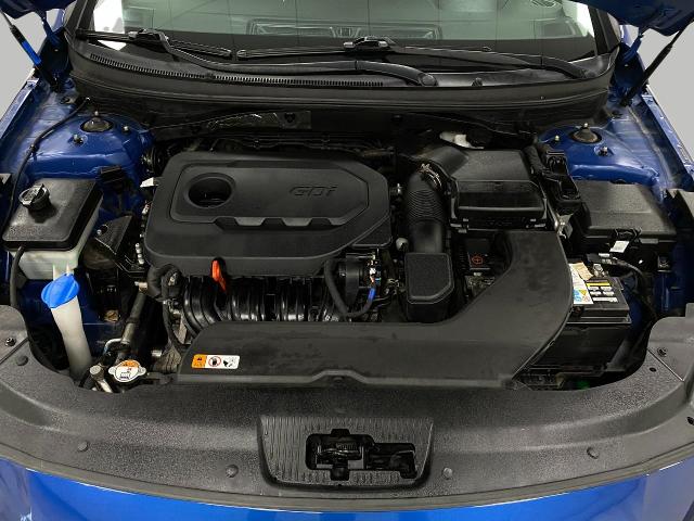 2017 Hyundai SONATA Vehicle Photo in Oshkosh, WI 54904