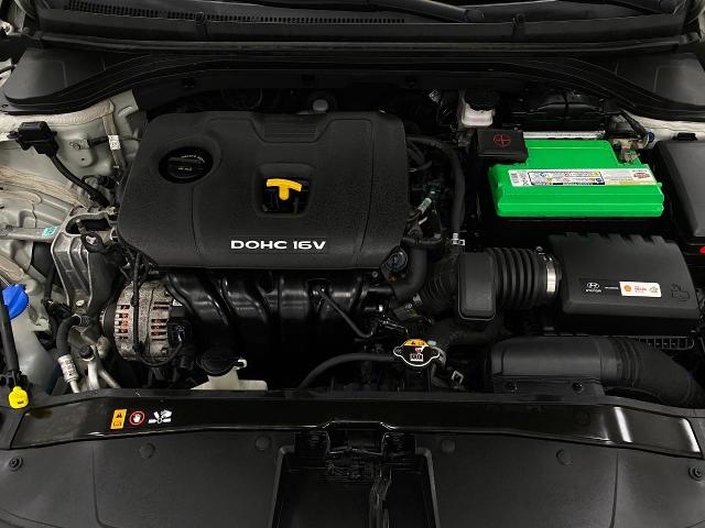 2017 Hyundai ELANTRA Vehicle Photo in Appleton, WI 54913