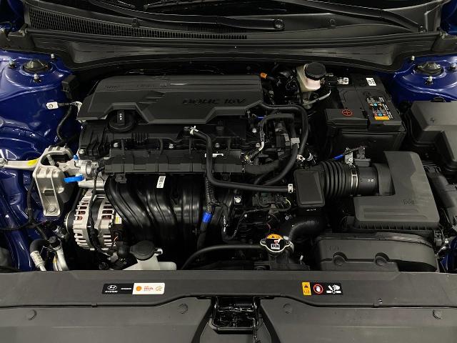 2025 Hyundai ELANTRA Vehicle Photo in Appleton, WI 54913