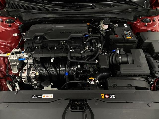 2025 Hyundai ELANTRA Vehicle Photo in Appleton, WI 54913