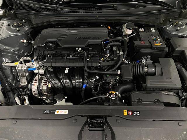 2025 Hyundai ELANTRA Vehicle Photo in Appleton, WI 54913