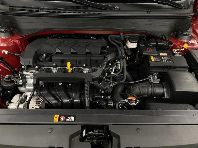 2025 Hyundai VENUE Vehicle Photo in Appleton, WI 54913