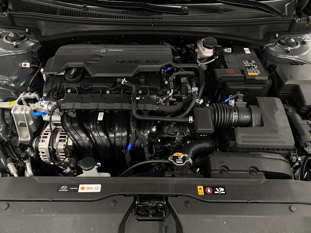 2025 Hyundai ELANTRA Vehicle Photo in Appleton, WI 54913