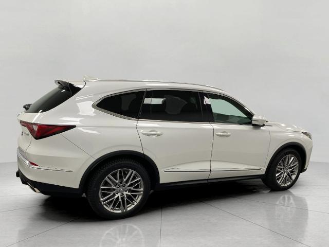 2022 Acura MDX Vehicle Photo in Appleton, WI 54913