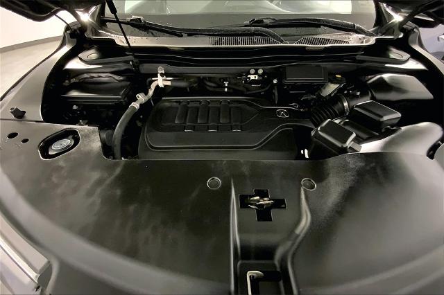 2017 Acura MDX Vehicle Photo in Lees Summit, MO 64086