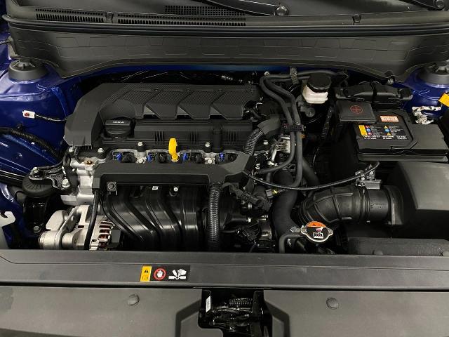 2025 Hyundai VENUE Vehicle Photo in Appleton, WI 54913