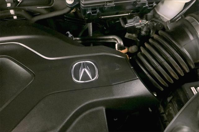 2017 Acura MDX Vehicle Photo in Lees Summit, MO 64086