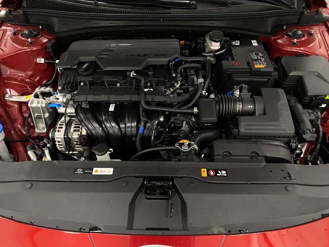 2025 Hyundai ELANTRA Vehicle Photo in Appleton, WI 54913