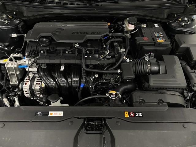 2025 Hyundai ELANTRA Vehicle Photo in Appleton, WI 54913