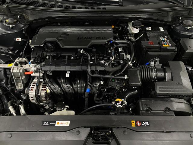 2024 Hyundai ELANTRA Vehicle Photo in Appleton, WI 54913