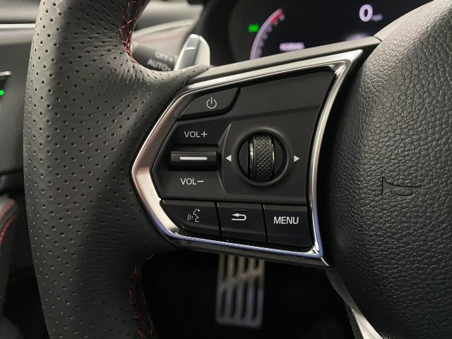 2025 Acura TLX Vehicle Photo in Appleton, WI 54913