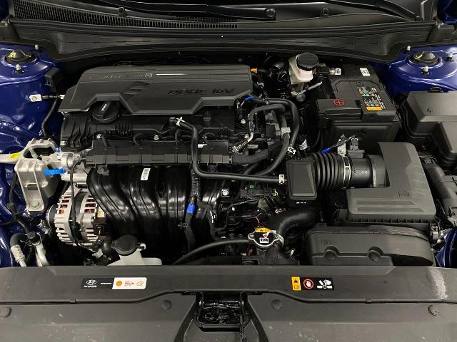 2025 Hyundai ELANTRA Vehicle Photo in Appleton, WI 54913
